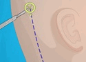 Operate Now Ear Surgery Games